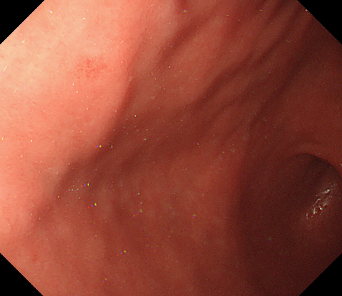 �݊p���O��